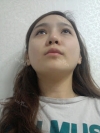 Facial Contouring Surgery+Square Jaw Reduction,+Chin Reduction,+Zygoma Reduction+Full face fat graft — Korea cost, reviews & before-after | MISOODA