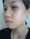 Misooda — Korea cost, reviews & before-after | MISOODA