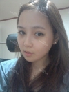 Facial Contouring Surgery+Square Jaw Reduction,+Chin Reduction,+Zygoma Reduction+Full face fat graft — Korea cost, reviews & before-after | MISOODA