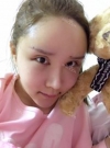 Lips and Fat Graft — Korea cost, reviews & before-after | MISOODA