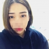 Incisional Double Eyelid, Lateral Canthoplasty, Eyelid Fat Removal — Korea cost, reviews & before-after | MISOODA