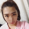 Incisional Double Eyelid, Lateral Canthoplasty, Eyelid Fat Removal — Korea cost, reviews & before-after | MISOODA