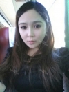 Facial Contouring Surgery+Square Jaw Reduction,+Chin Reduction,+Zygoma Reduction+Full face fat graft — Korea cost, reviews & before-after | MISOODA