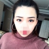 Incisional Double Eyelid, Lateral Canthoplasty, Eyelid Fat Removal — Korea cost, reviews & before-after | MISOODA