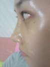 Misooda — Korea cost, reviews & before-after | MISOODA