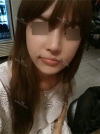 Nose Revision Surgery (3 times) — Korea cost, reviews & before-after | MISOODA
