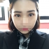 Incisional Double Eyelid, Lateral Canthoplasty, Eyelid Fat Removal — Korea cost, reviews & before-after | MISOODA