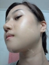 Misooda — Korea cost, reviews & before-after | MISOODA