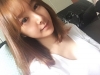 Cheekbones reduction, incision eyelid surgery , fat grafting, nose revision surgery — Korea cost, reviews & before-after | MISOODA