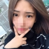 Incisional Double Eyelid, Lateral Canthoplasty, Eyelid Fat Removal — Korea cost, reviews & before-after | MISOODA