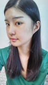 Boring to boomz — Korea cost, reviews & before-after | MISOODA
