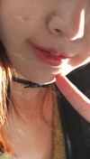 lips correction — Korea cost, reviews & before-after | MISOODA