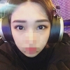 Incisional Double Eyelid, Lateral Canthoplasty, Eyelid Fat Removal — Korea cost, reviews & before-after | MISOODA