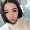 Incisional Double Eyelid, Lateral Canthoplasty, Eyelid Fat Removal — Korea cost, reviews & before-after | MISOODA