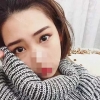 Incisional Double Eyelid, Lateral Canthoplasty, Eyelid Fat Removal — Korea cost, reviews & before-after | MISOODA