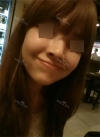 Nose Revision Surgery (3 times) — Korea cost, reviews & before-after | MISOODA