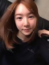 Cheekbones reduction, incision eyelid surgery , fat grafting, nose revision surgery — Korea cost, reviews & before-after | MISOODA