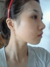 Misooda — Korea cost, reviews & before-after | MISOODA