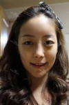 Misooda — Korea cost, reviews & before-after | MISOODA