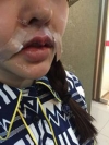 my beautiful lips — Korea cost, reviews & before-after | MISOODA