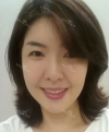 Stem cell Fat grafting + Smile V Lifting + Laser Lifting — Korea cost, reviews & before-after | MISOODA