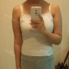 Arms, Braline, Thighs Liposuction — Korea cost, reviews & before-after | MISOODA