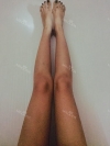 Arms, Braline, Thighs Liposuction — Korea cost, reviews & before-after | MISOODA