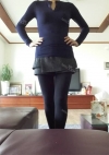 Sedot Lemak Lengan, Perut dan Paha — Korea cost, reviews & before-after | MISOODA