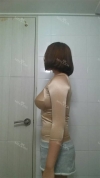 Arms, Braline, Thighs Liposuction — Korea cost, reviews & before-after | MISOODA