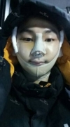 V-ライン — Korea cost, reviews & before-after | MISOODA