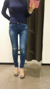 Sedot Lemak Lengan, Perut dan Paha — Korea cost, reviews & before-after | MISOODA