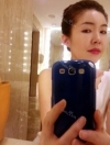 Stem cell Fat grafting + Smile V Lifting + Laser Lifting — Korea cost, reviews & before-after | MISOODA