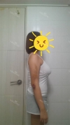 Arms, Braline, Thighs Liposuction — Korea cost, reviews & before-after | MISOODA