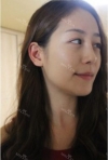 Misooda — Korea cost, reviews & before-after | MISOODA