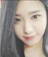 facial contouring — Korea cost, reviews & before-after | MISOODA