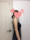 Arms, Braline, Thighs Liposuction — Korea cost, reviews & before-after | MISOODA