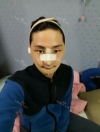 V-ライン — Korea cost, reviews & before-after | MISOODA