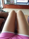 Sedot Lemak Lengan, Perut dan Paha — Korea cost, reviews & before-after | MISOODA