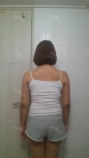 Arms, Braline, Thighs Liposuction — Korea cost, reviews & before-after | MISOODA
