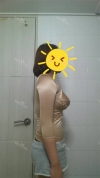 Arms, Braline, Thighs Liposuction — Korea cost, reviews & before-after | MISOODA