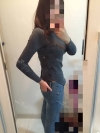 Arms, Braline, Thighs Liposuction — Korea cost, reviews & before-after | MISOODA