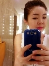 Stem cell Fat grafting + Smile V Lifting + Laser Lifting — Korea cost, reviews & before-after | MISOODA