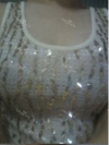 Breast Augmentation Surgery — Korea cost, reviews & before-after | MISOODA