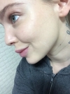 UK Model PIXIEE's skin treatment in Korea — Korea cost, reviews & before-after | MISOODA