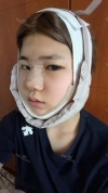 Misooda — Korea cost, reviews & before-after | MISOODA