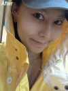 Misooda — Korea cost, reviews & before-after | MISOODA
