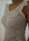 Teardrop implant breast augmentation — Korea cost, reviews & before-after | MISOODA