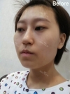 Misooda — Korea cost, reviews & before-after | MISOODA