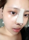 Misooda — Korea cost, reviews & before-after | MISOODA