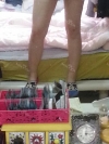 Lower body thigh liposuction — Korea cost, reviews & before-after | MISOODA